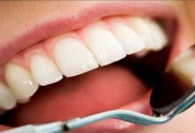 افزایش خطر ابتلا به سرطان کبد با رعایت نکردن بهداشت دهان