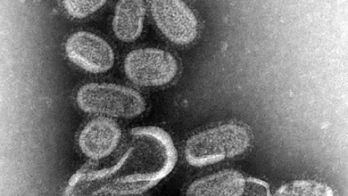 رابطه خطرناک آلودگی هوا و آنفلوآنزا 5 اکوبورس